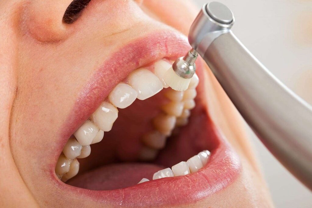 pulizia-denti-gengive